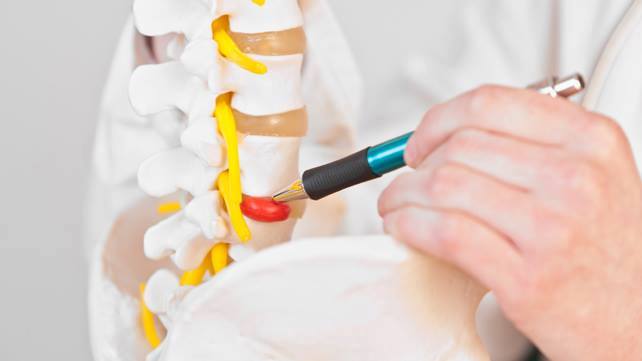 A person is painting the spine of a spinal cord.